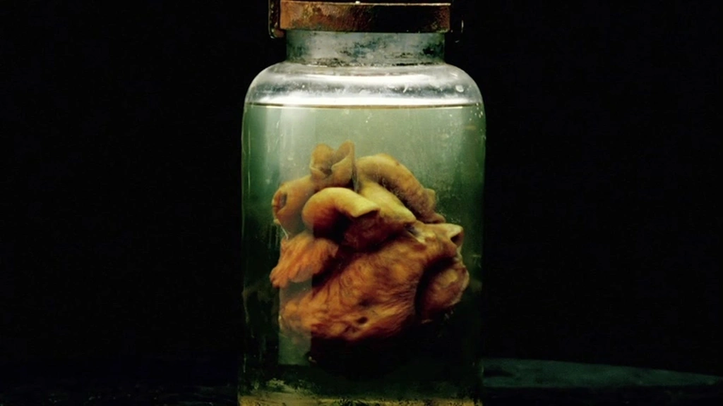 the strain 2 