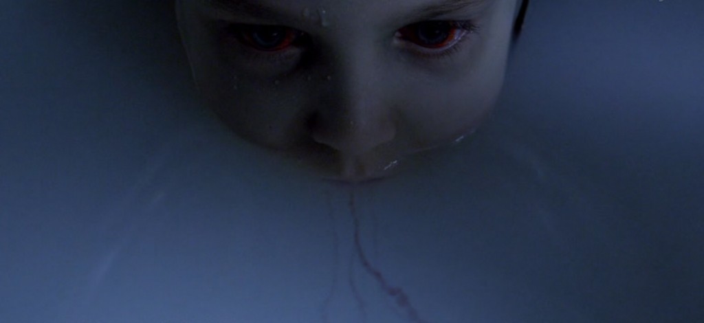 the strain 7