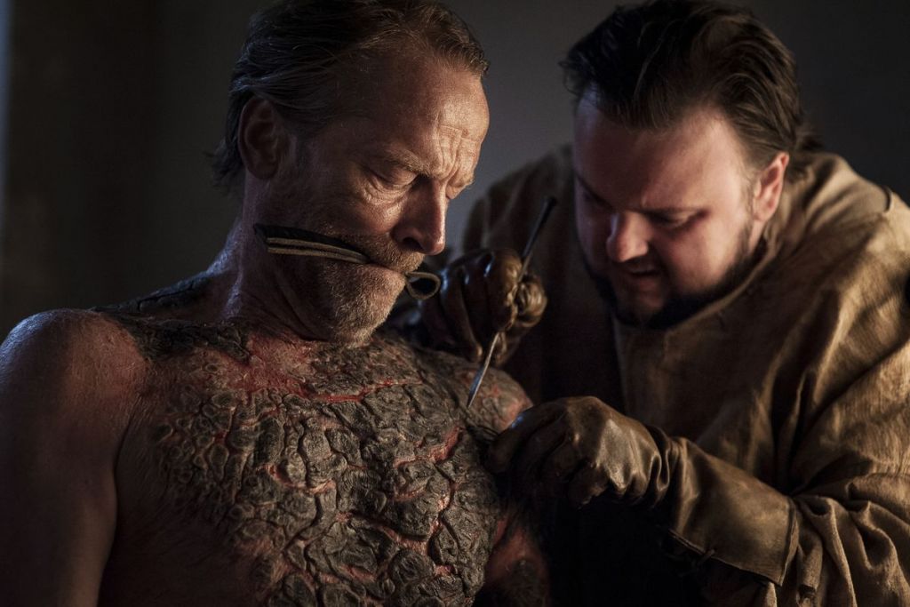 gra o tron jorah mormont dragonscale szara łuszczyca class="wp-image-90657" 