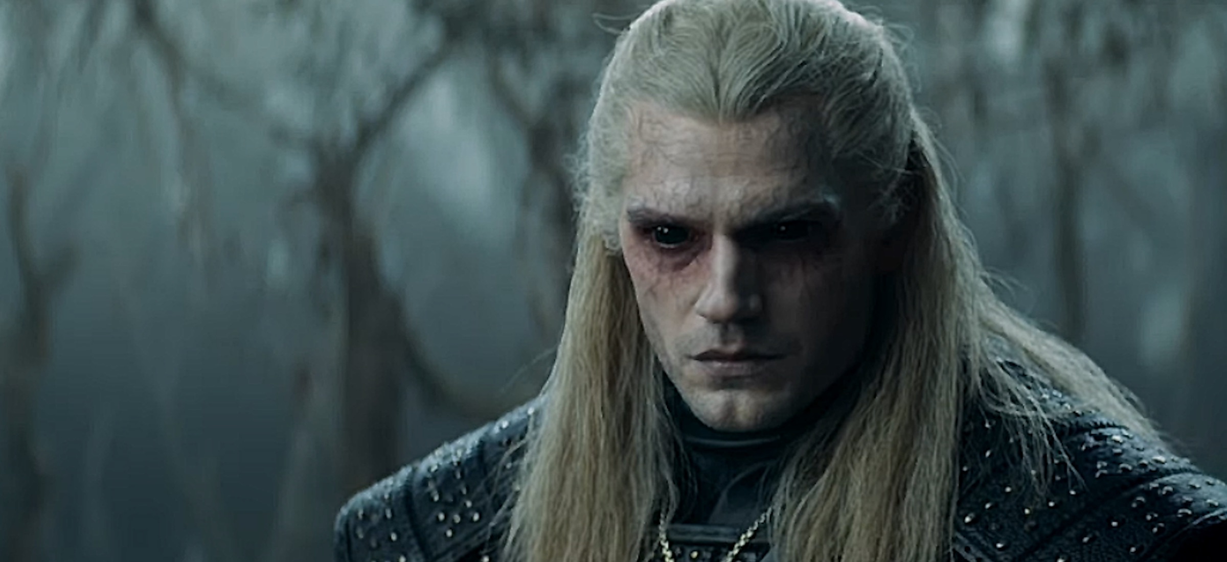 henry cavill kontuzja
