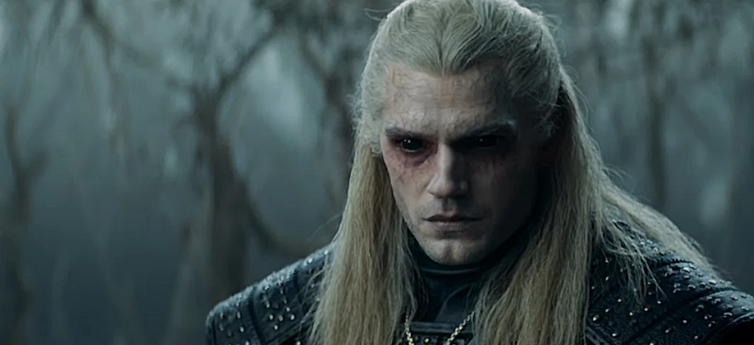 henry cavill kontuzja