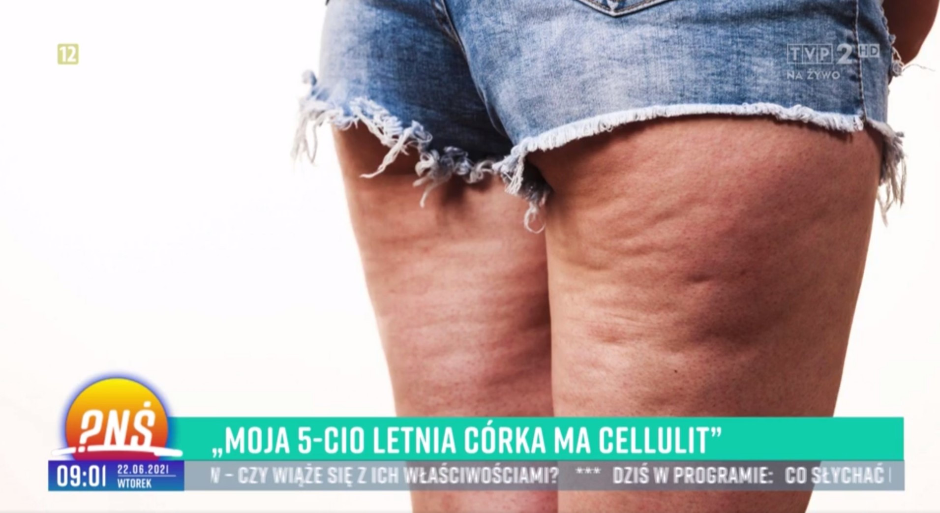 pytanie na śniadanie cellulit tvp