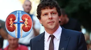 jesse eisenberg odda swoja nerke obcej osobie