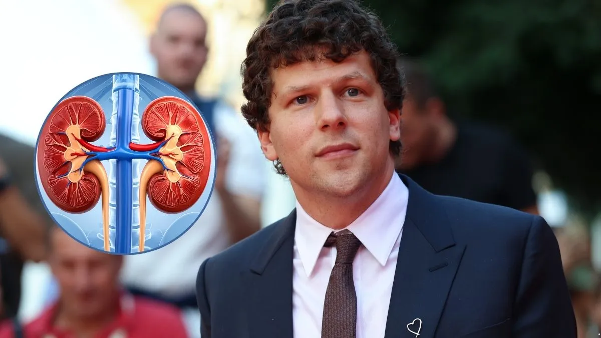 jesse eisenberg odda swoja nerke obcej osobie