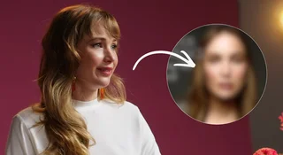 jennifer lawrence medycyna estetyczna felieton